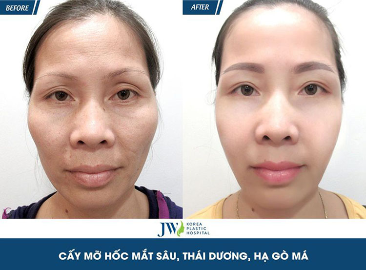 cai lao guong mat 3m 6 1