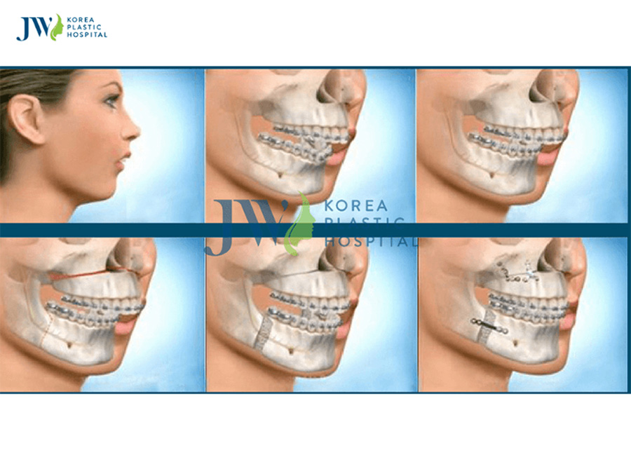 Phẫu thuật thẩm mỹ răng hàm mặt