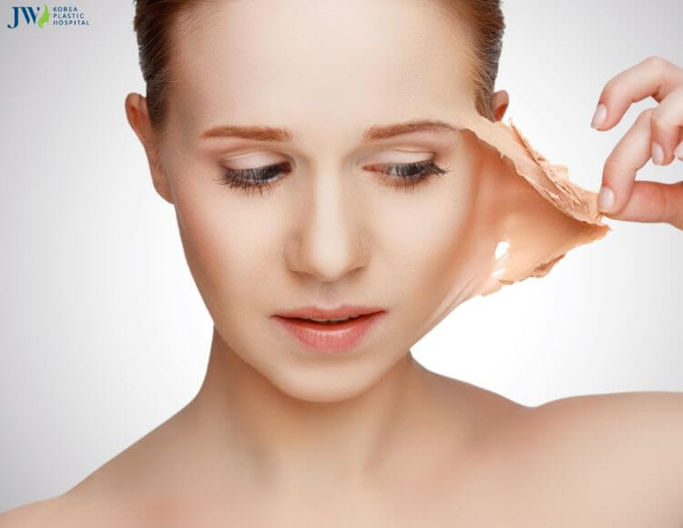 Căng chỉ nâng cơ - Liệu pháp trẻ hoá không cần phẫu thuật 3