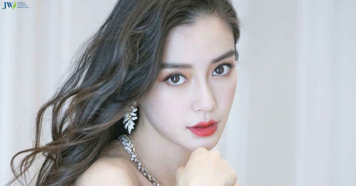 Căng chỉ nâng cơ - Liệu pháp trẻ hoá không cần phẫu thuật thumb