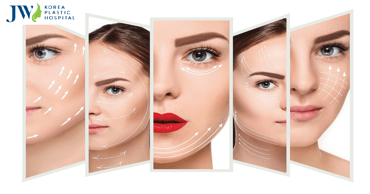 cay chi collagen 1