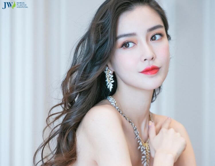 Nhược điểm của căng chỉ collagen 1