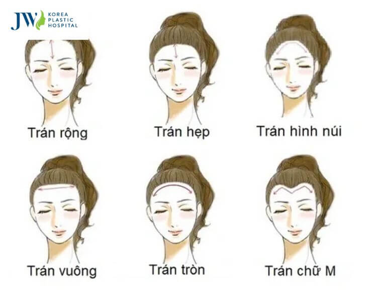 Tướng mặt nữ