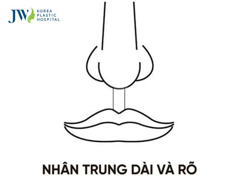 Tướng mặt nữ