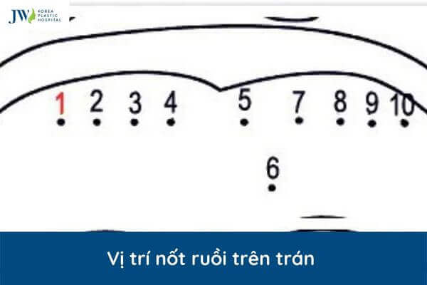 Vi tri not ruoi
