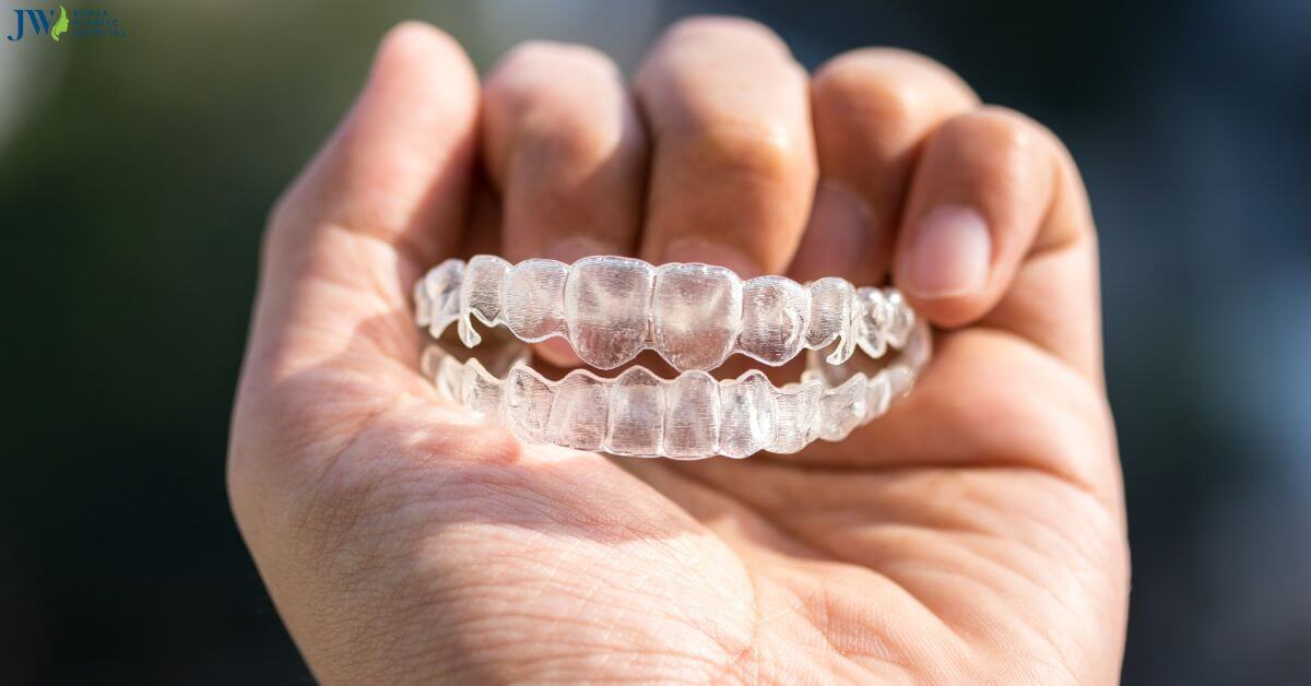 Có bao nhiêu loại niềng răng trong suốt? thumb