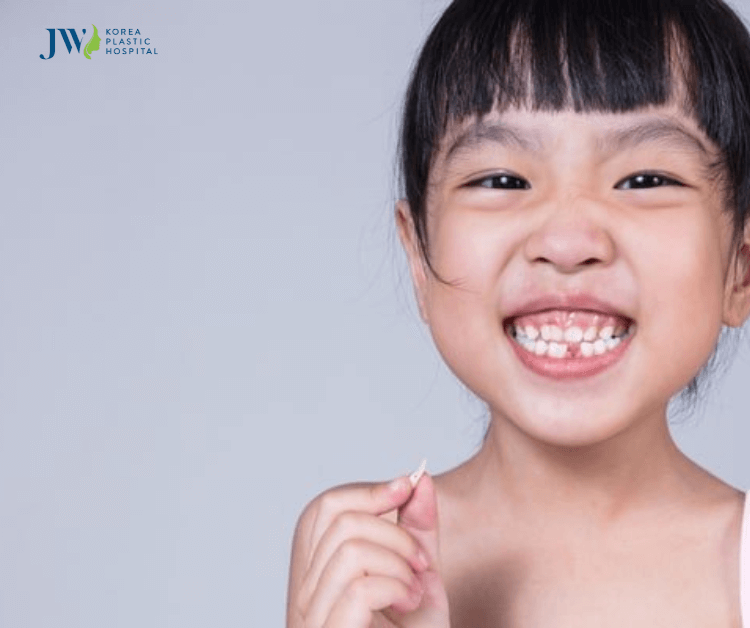 niềng răng cho trẻ 9 tuổi 