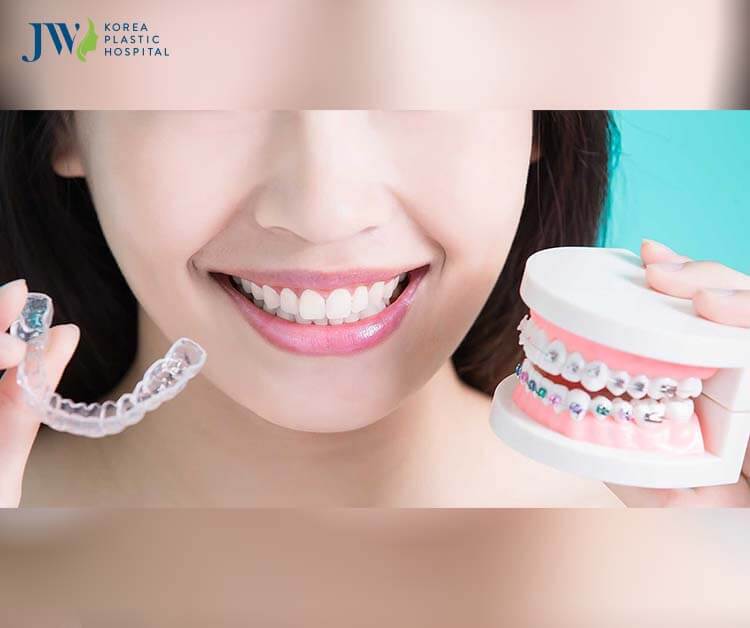 Niềng răng trong suốt AI nhẹ nhàng hơn