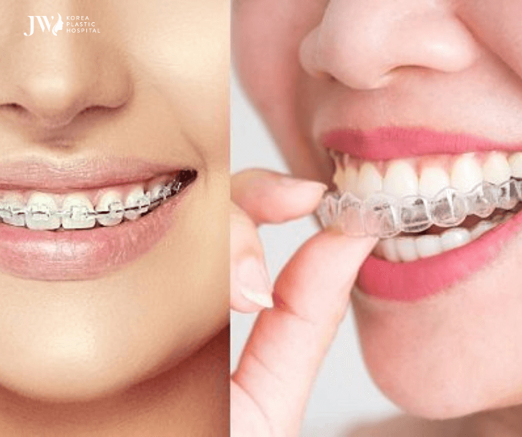 răng yếu có niềng răng được không