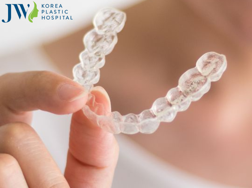 Ưu điểm vượt bậc của niềng răng trong suốt AI
