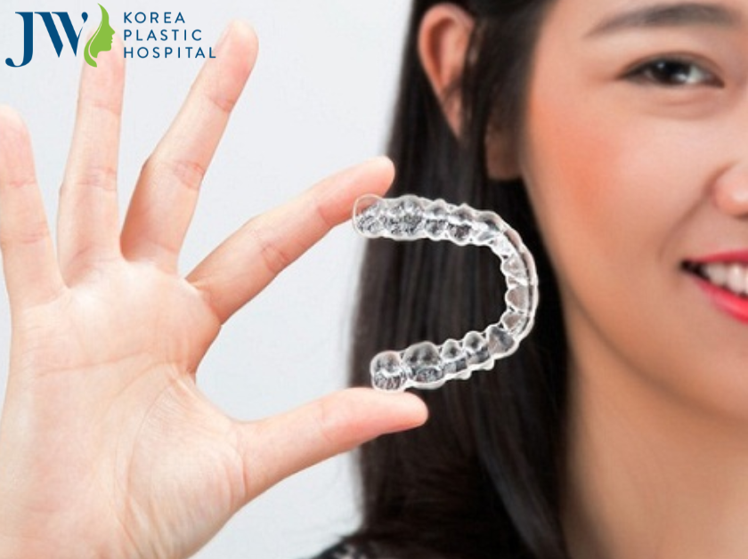 Quy trình đeo niềng răng trong suốt AI