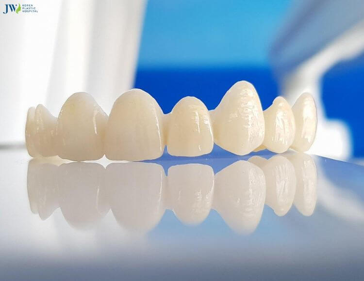 Bọc sứ toàn hàm có mấy loại và chi phí như thế nào? 3