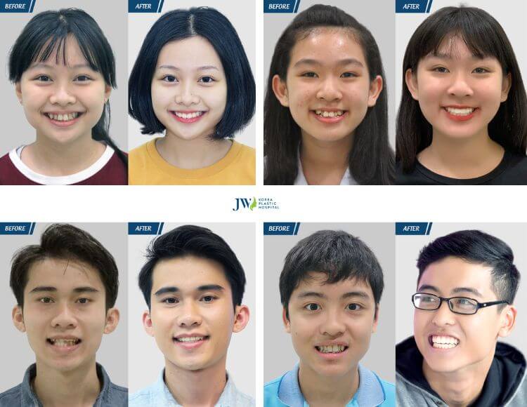 Kết quả điều trị tại JW