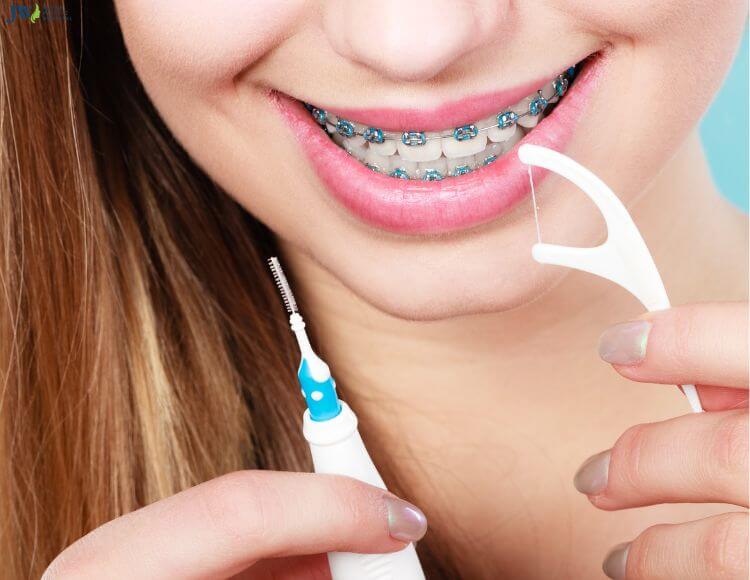 Mách bạn 7 bí quyết vệ sinh răng miệng khi niềng chuẩn nha khoa 3