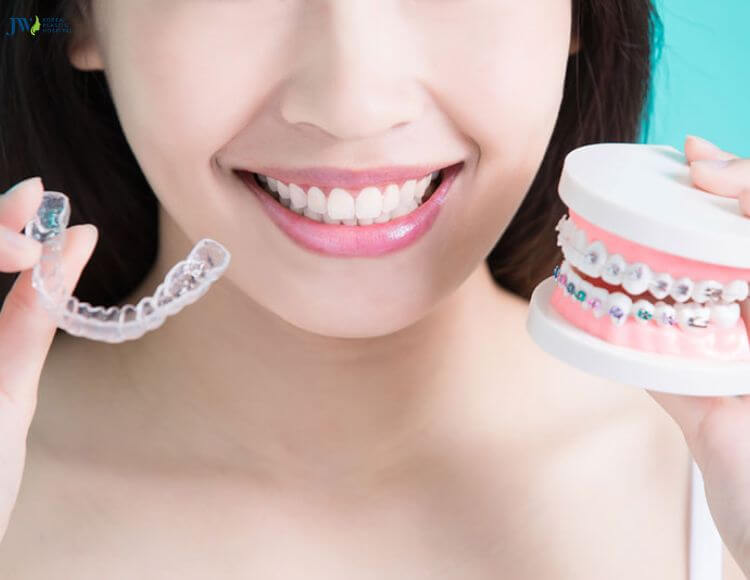 Niểng răng mắc cài và trong suốt