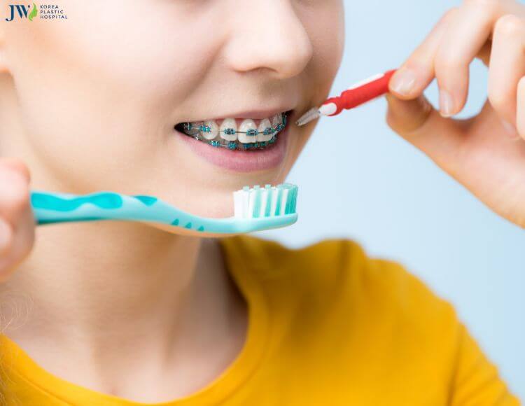 Lựa chọn bài chải phù hợp cho người niềng răng