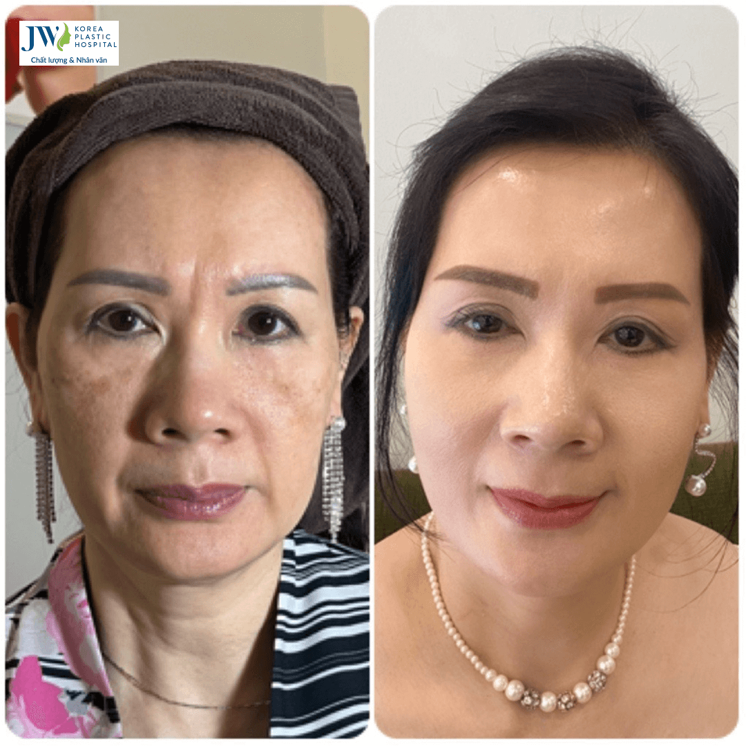 Hiệu quả công nghệ 3S PLUS
