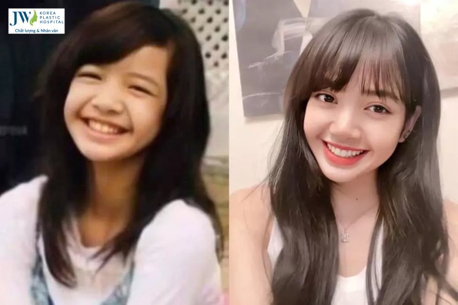 Blackpink