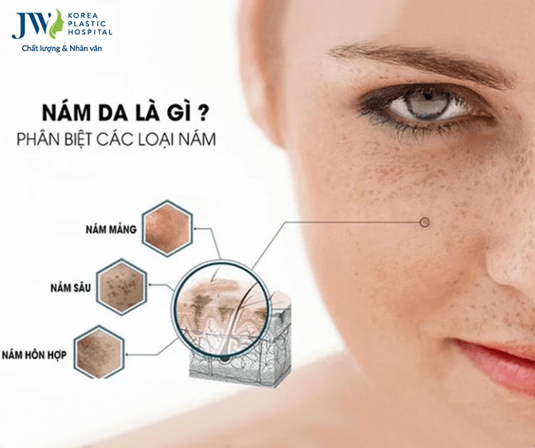Công nghệ 3S PLUS

