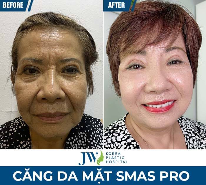 bệnh viện thẩm mỹ JW Hàn Quốc