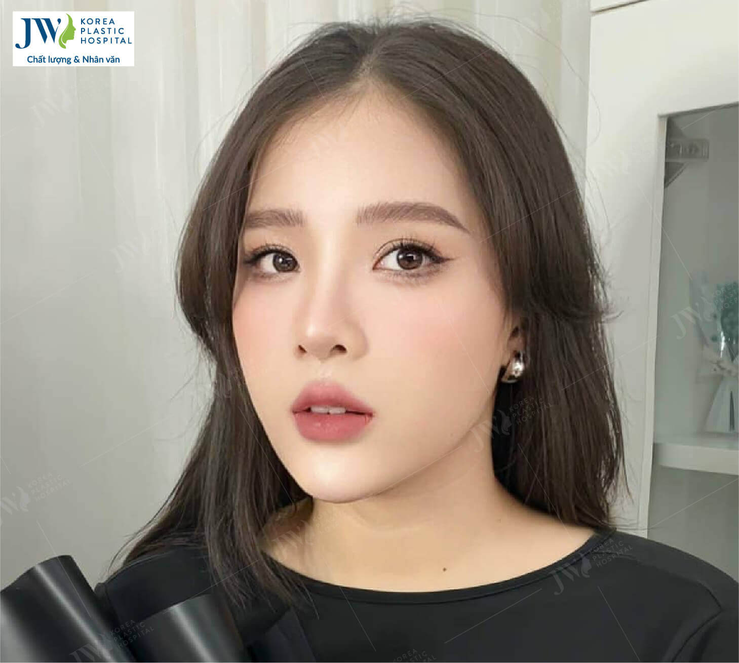 phẫu thuật hàm hô