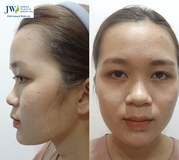 phẫu thuật thẩm mỹ