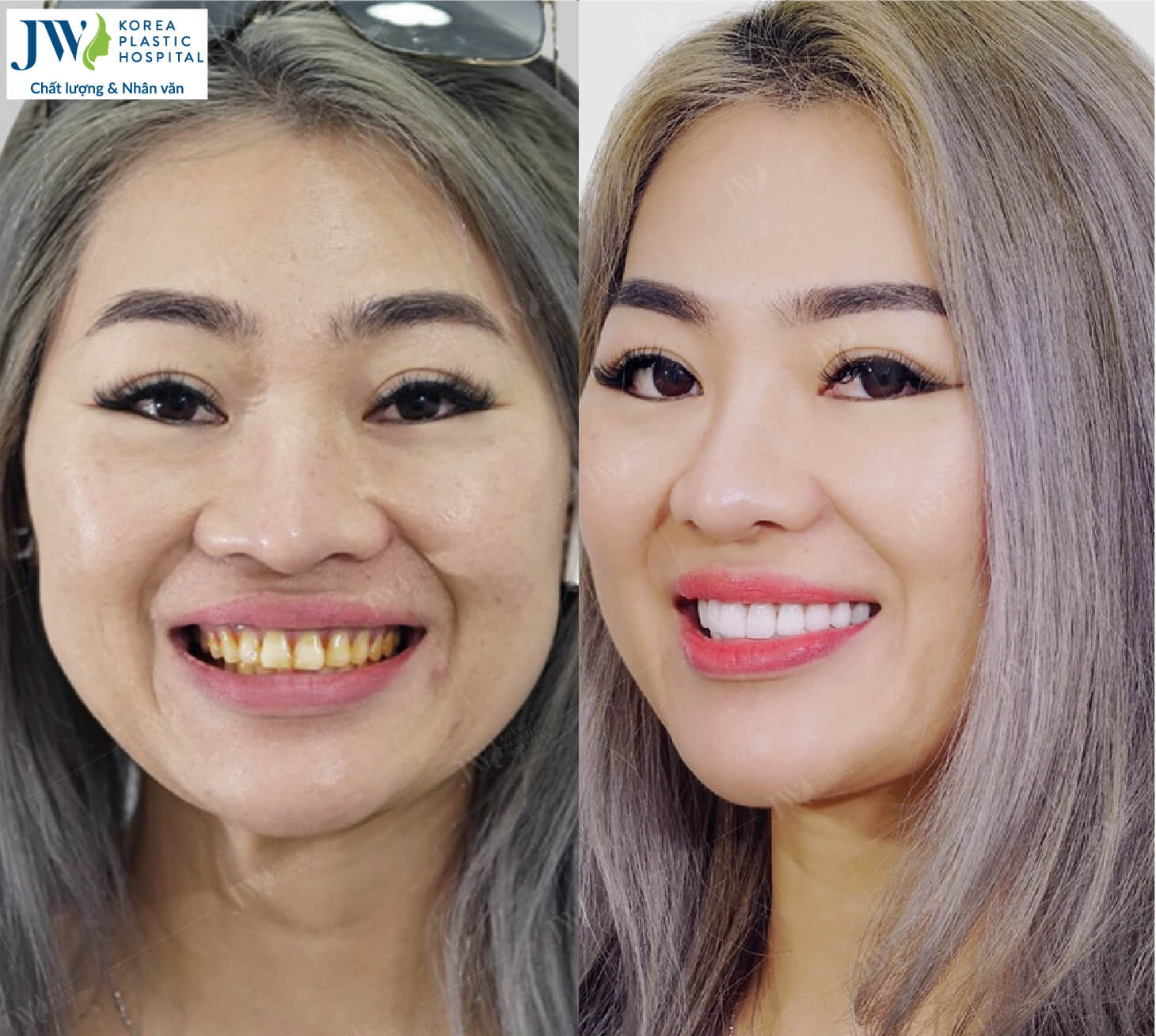 Việt kiều về nước