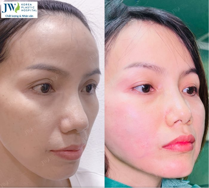 Việt kiều về nước