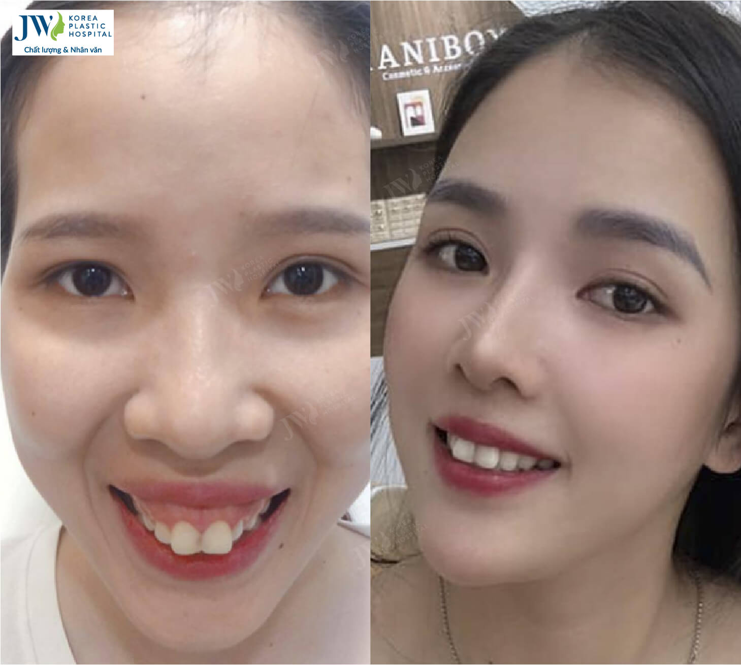 phẫu thuật thẩm mỹ