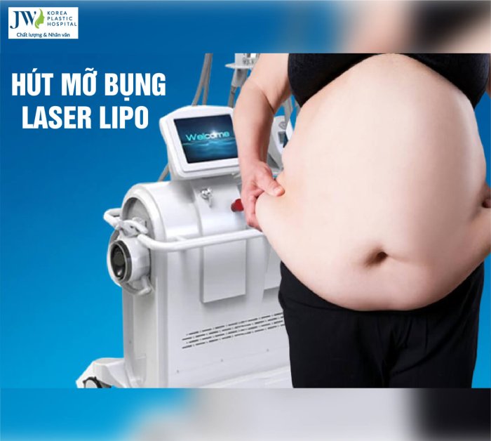 hút mỡ bụng