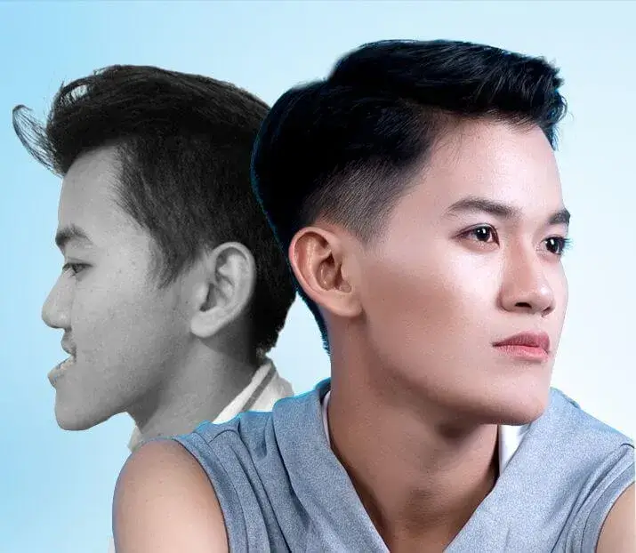 Phẫu thuật thẩm mỹ là gì - Hiểu đúng về giá trị của cái đẹp - Ảnh 6