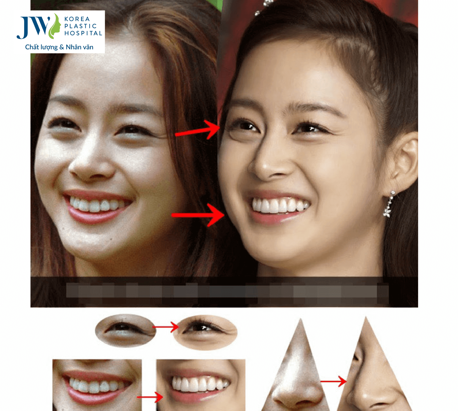Kim Tae Hee