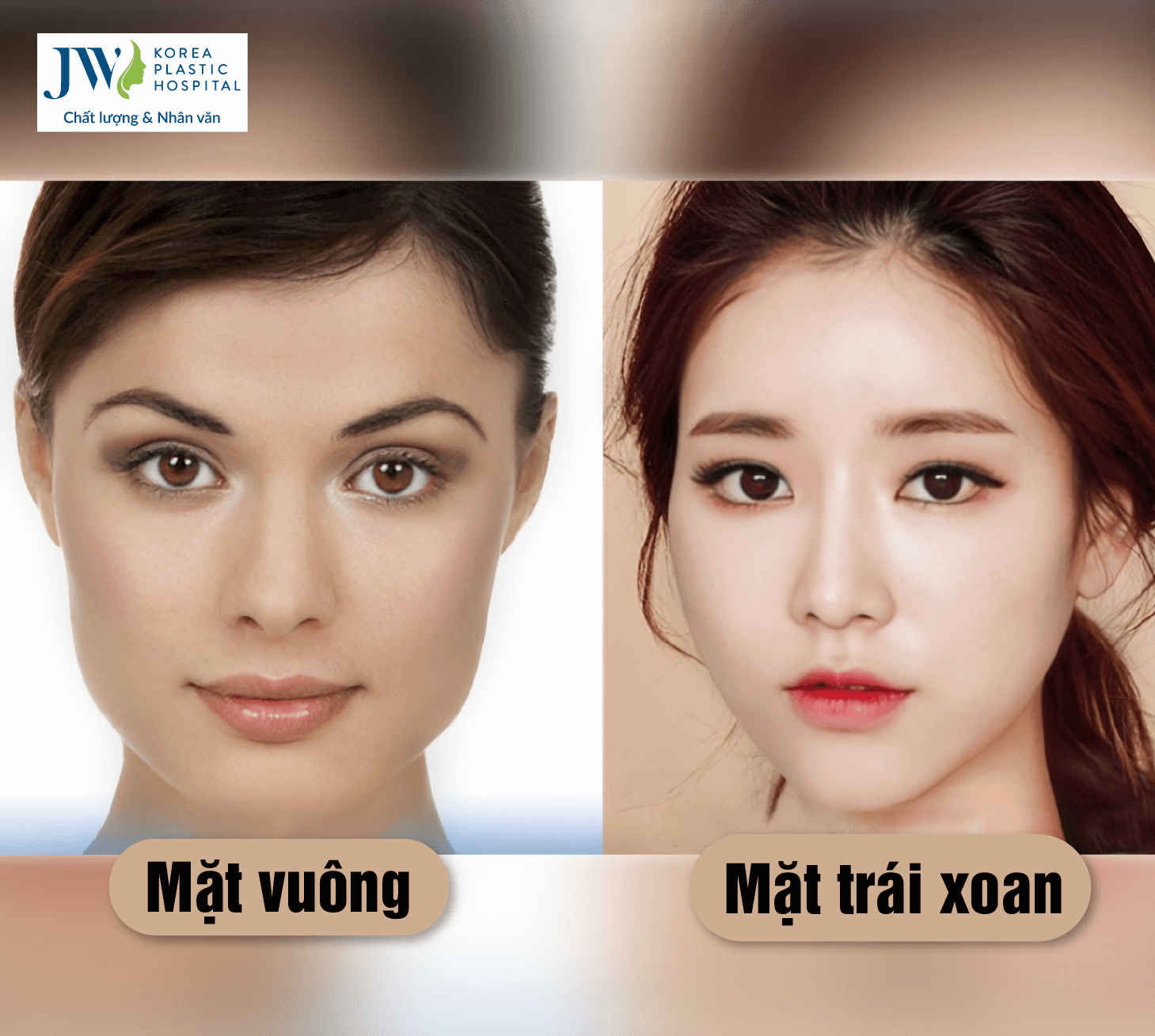 Mặt trái xoan