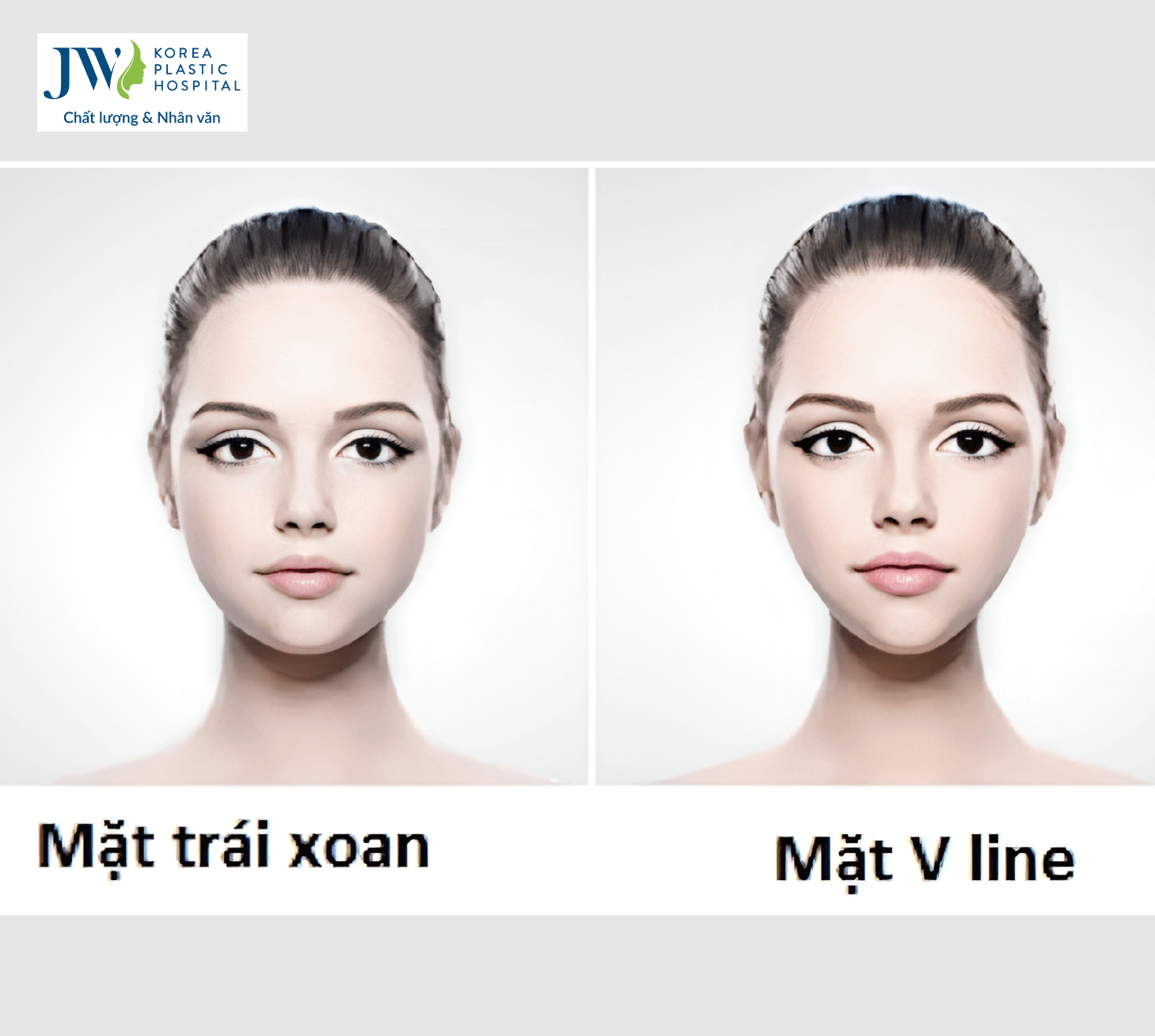 Mặt trái xoan