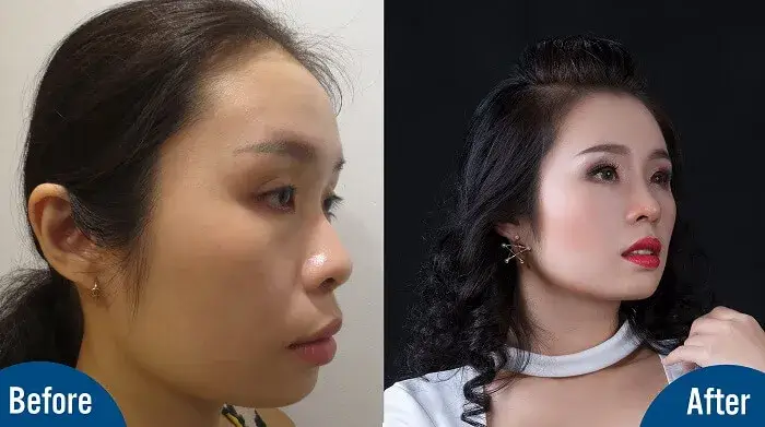 Phẫu thuật thẩm mỹ là gì - Hiểu đúng về giá trị của cái đẹp - Ảnh 4