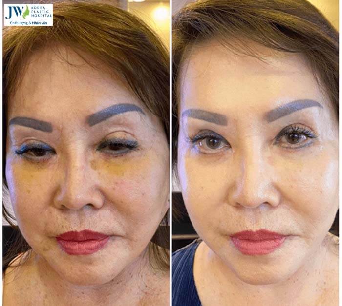 Thẩm mỹ không xâm lấn