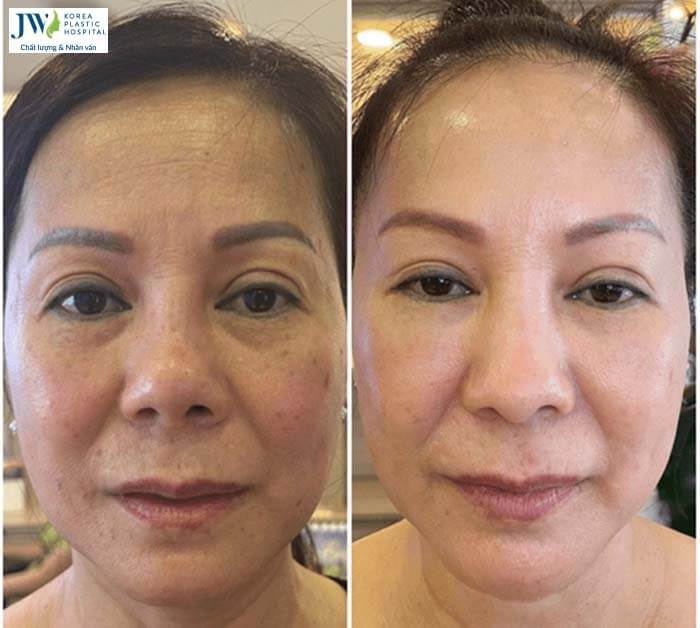 Thẩm mỹ không xâm lấn