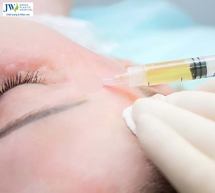 Thẩm mỹ không xâm lấn