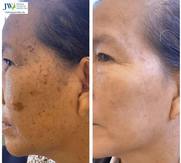 Thẩm mỹ không xâm lấn