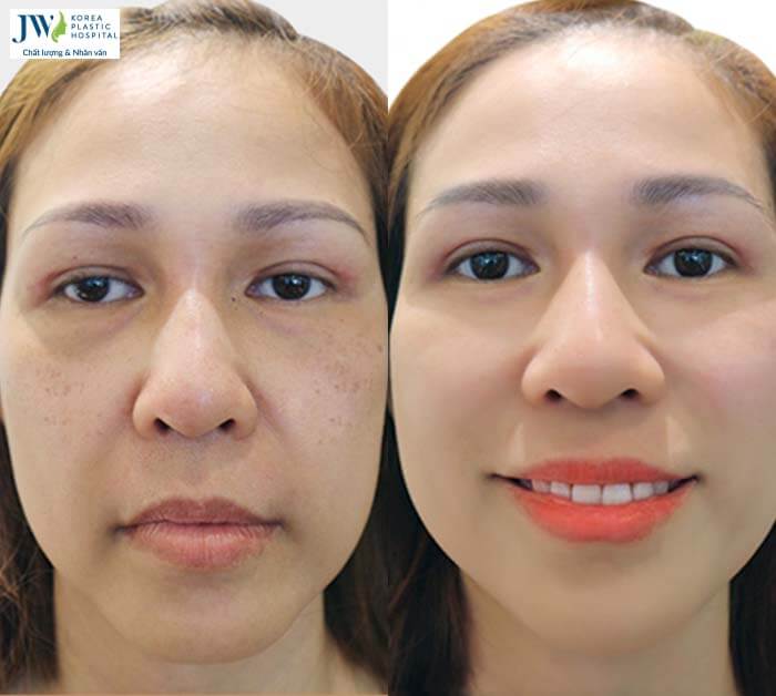 Thẩm mỹ không xâm lấn