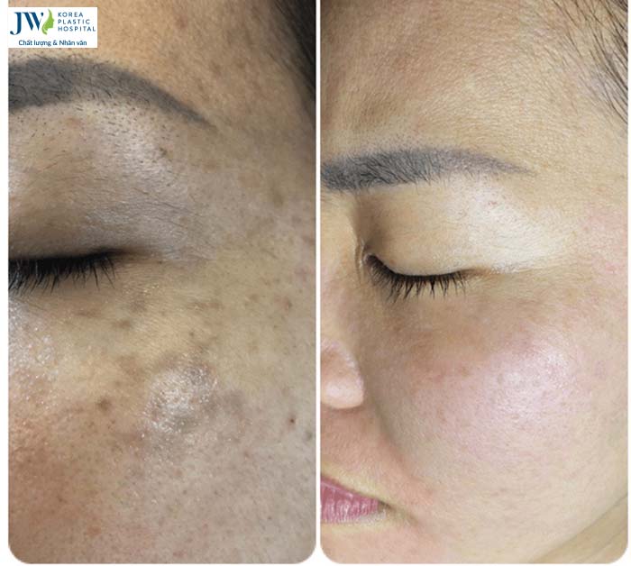 Thẩm mỹ không xâm lấn