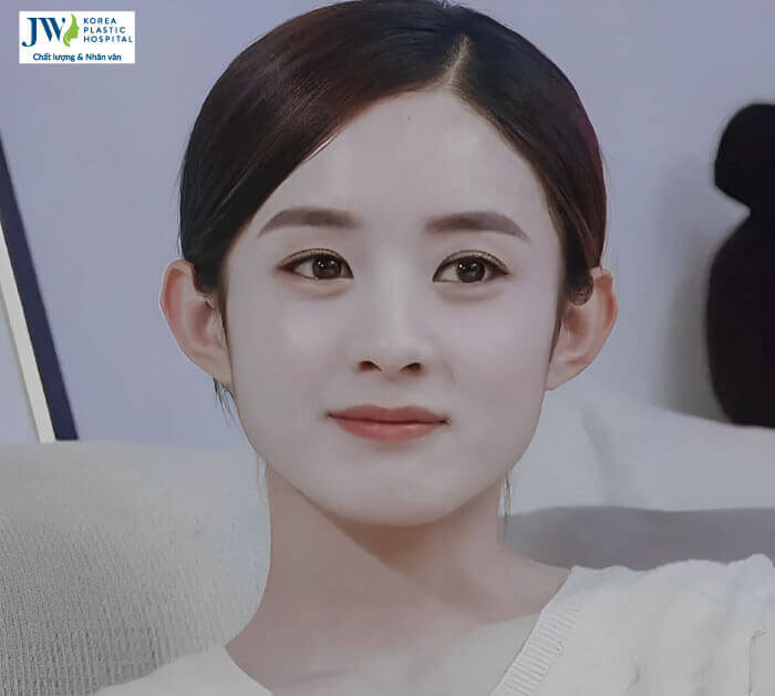 phụ nữ mặt tròn