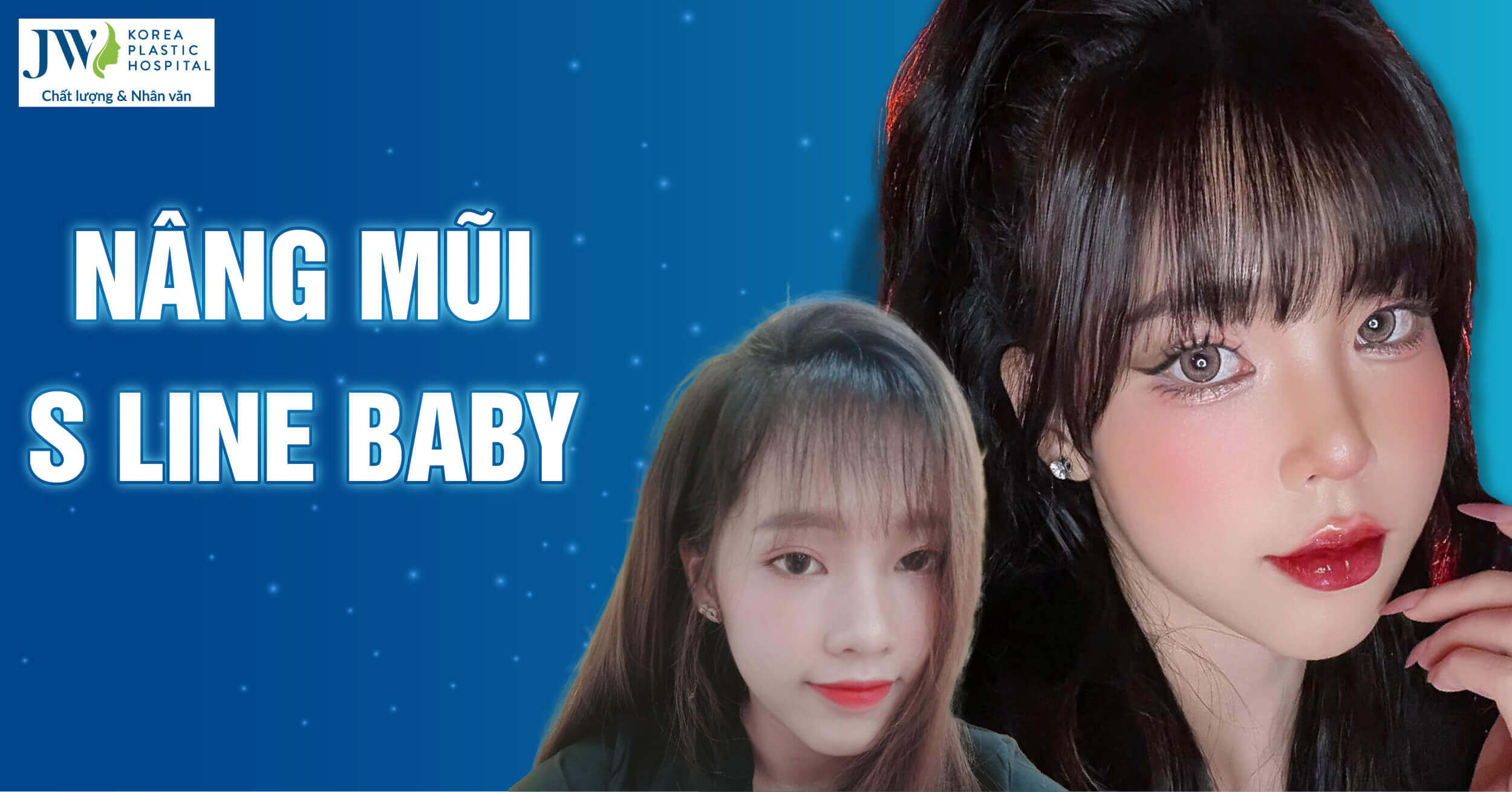 Nâng mũi S Line Baby