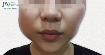 Silicon lỏng