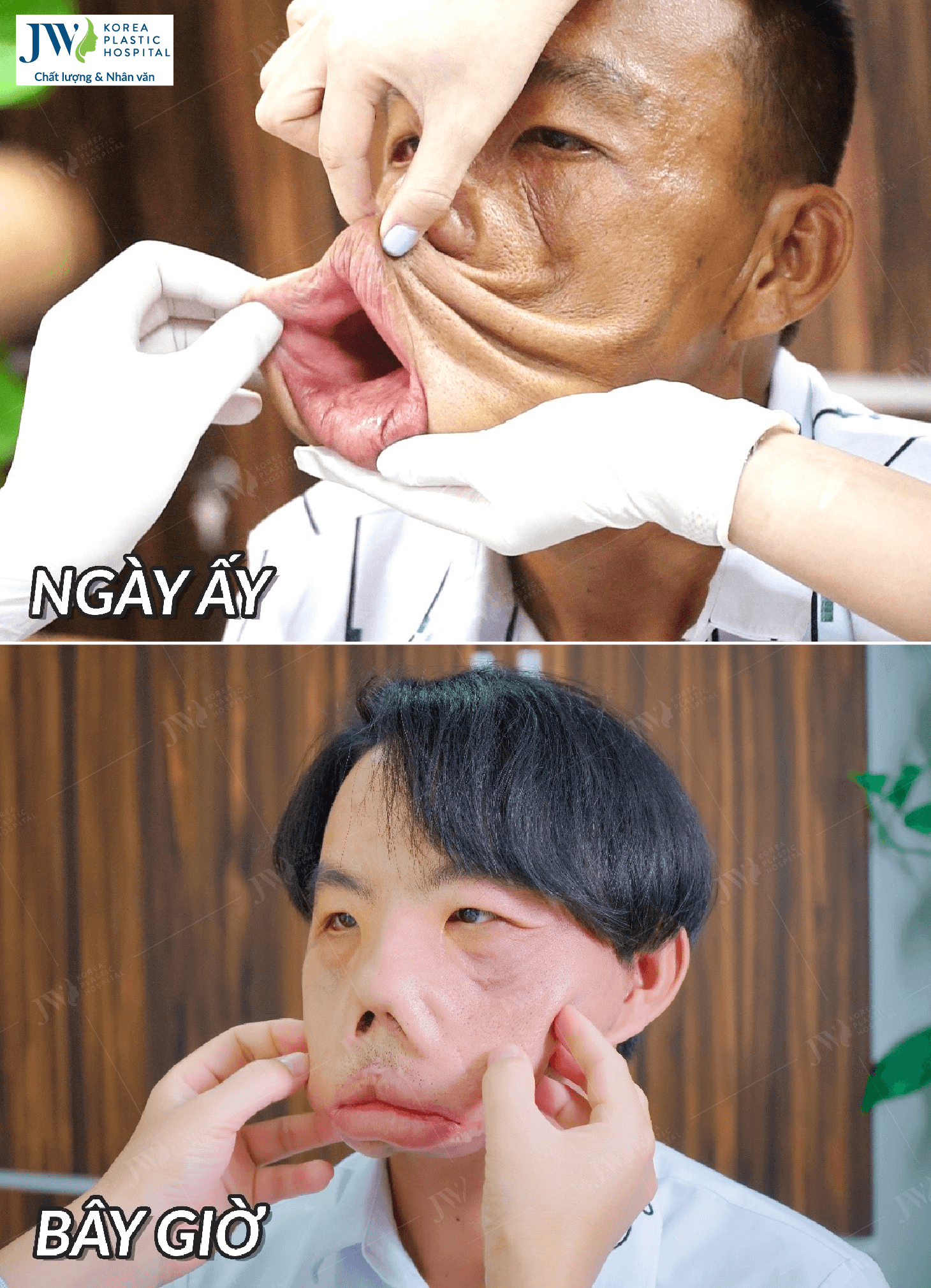 anh-men-truoc-khi-phau-thuat