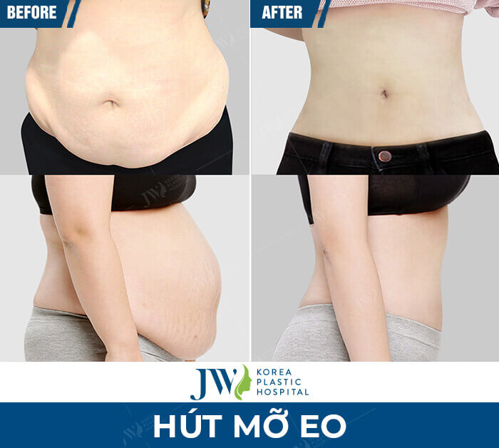 hut-mo-eo-jw