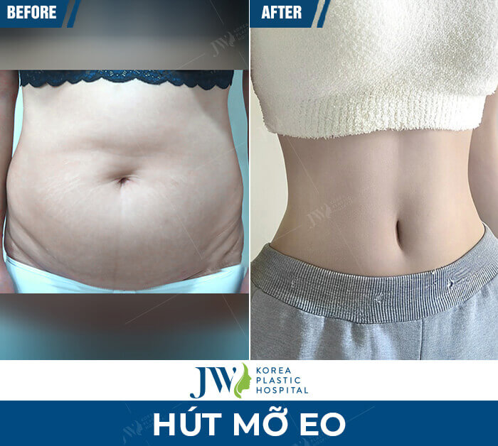 hut-mo-eo-thon-jw