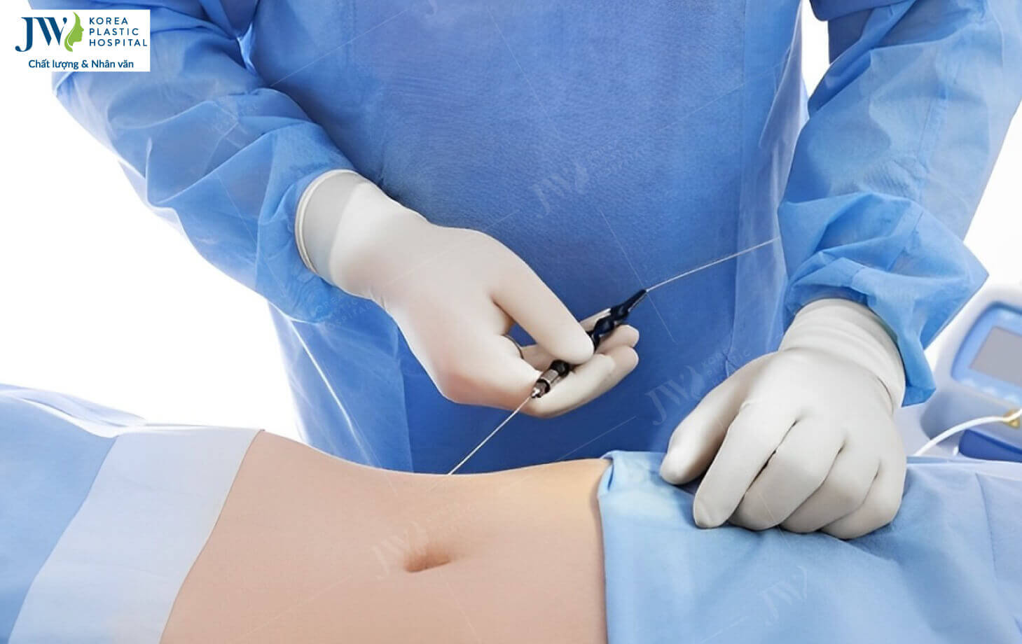 hut-mo-laser-lipo