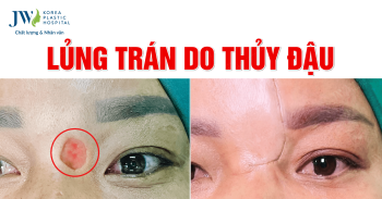 lủng trán