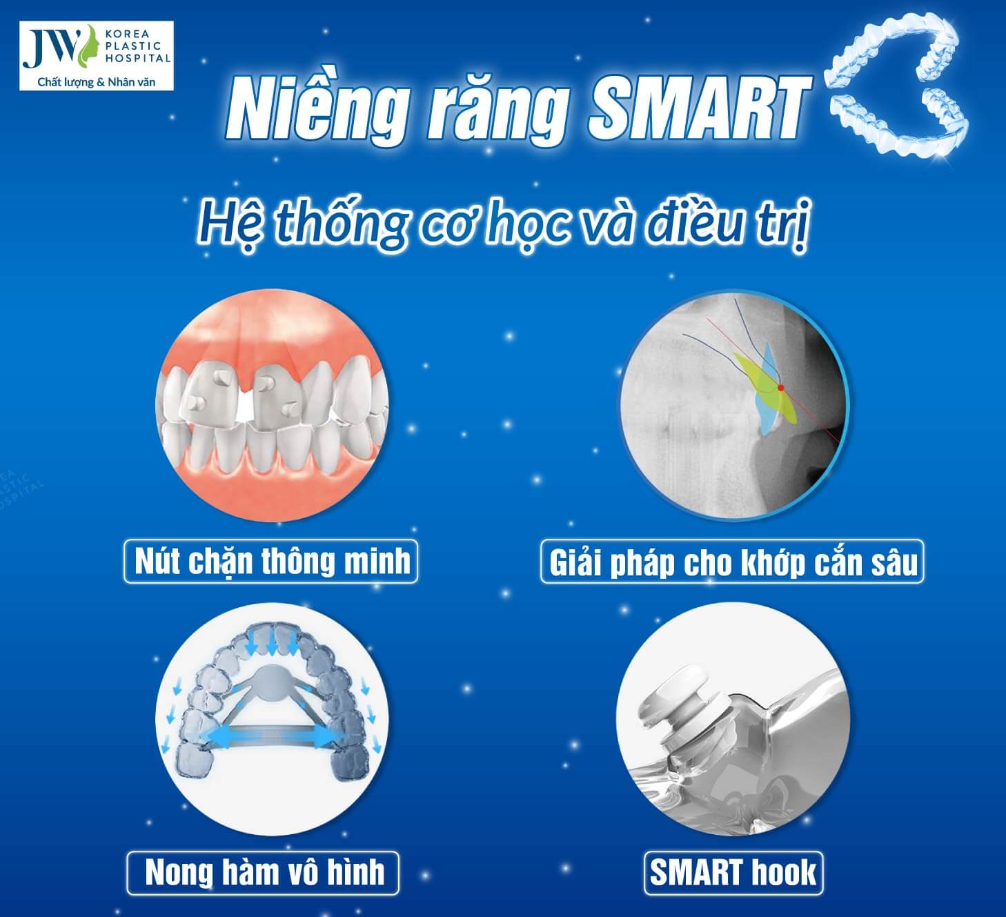 niềng răng SMART